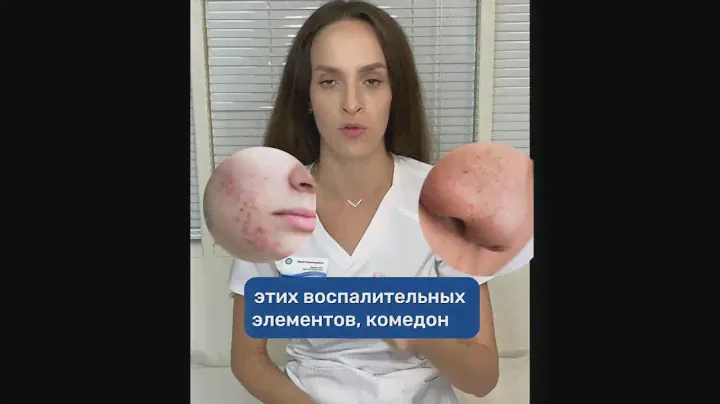 Можно вылечить  акне навсегда? #дерматолог #дерматологмосква #акне #прыщи #прыщ #дерматология